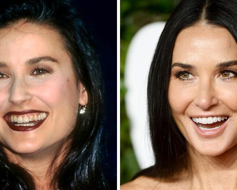 15 Stars Who Prove That a New Smile Can Totally Transform the Way We Look
