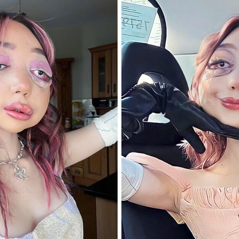 Despite Suffering From a Unique Facial Condition This Young Woman Uses Her Platform to Educate People